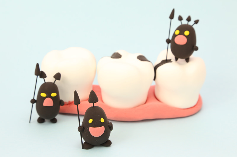 虫歯の進行段階と主な症状について