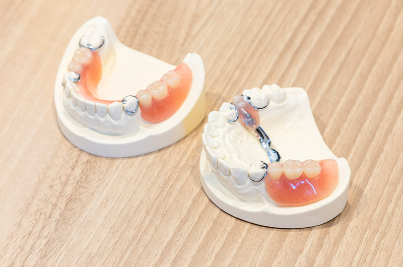 入れ歯の取り扱いの注意点