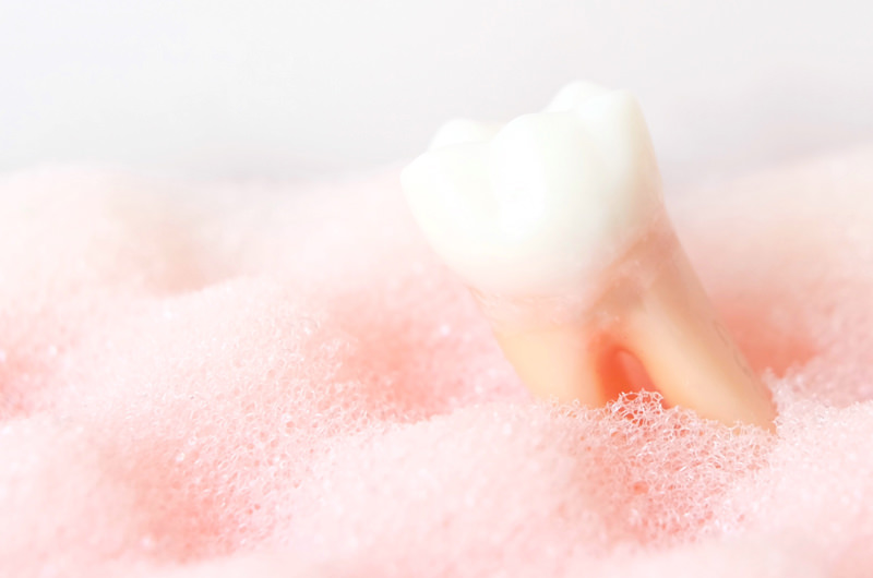 歯周病について「歯茎から血が出る」は歯周病の初期サイン